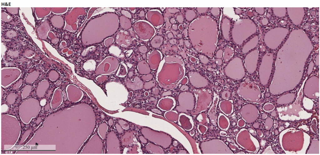 Lab Guide Endocrine Pathology – Lab Pathology MDKKU